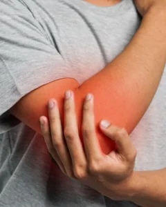 A person suffering with tennis elbow pain